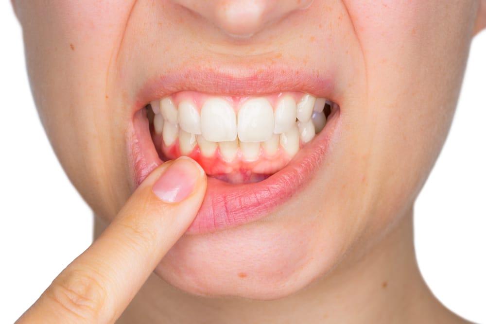 woman showing her gums