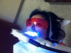 Plasma Arc Light (PAC) that can be used for both fast-curing and chair-side dental bleaching